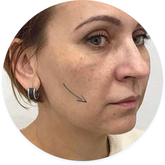 Можливі варінти підтяжки