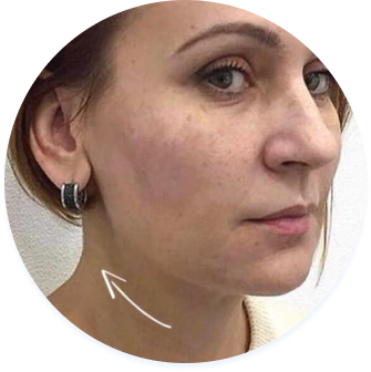 Можливі варінти підтяжки